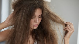 These Hair Oils Might Not Be As Beneficial For You As You May Think