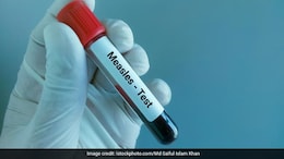 Bangladesh Measles Outbreak Claims 9 More Lives; Total Deaths Near 1,100