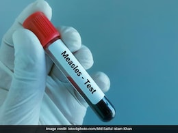 सिंध में खसरे से 17 बच्चों की मौत, 3 महीने में 1100 से ज्यादा मामले आए सामने