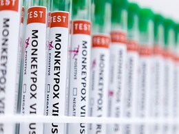 Pakistan Reports 1st M-Pox Case As Saudi Arabia Returnee Tests Positive Pakistan Reports 1st M-Pox Case As Saudi Arabia Returnee Tests Positive