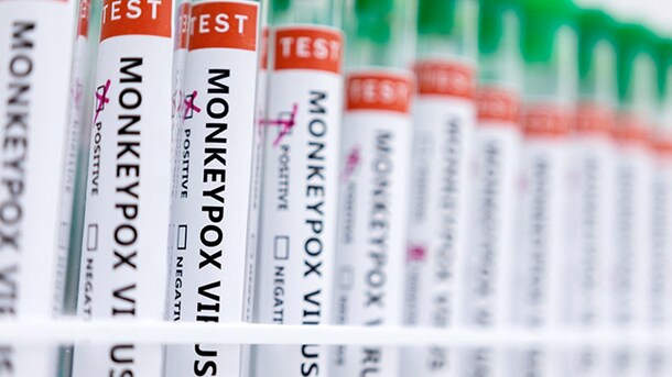 Indian Researchers Find Method To Decode Monkeypox Virus, Aid Diagnostics
