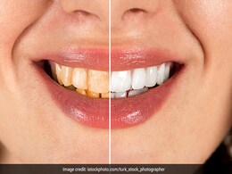 मुस्कुराते ही पीले दांत बाहर झांकने लगते हैं, तो बस केले का छिलका इस्तेमाल करने से मोतियों जैसे चमक जाएंगे सारे दांत, इस तरह बनाएं टीथ वाइटनिंग पेस्ट मुस्कुराते ही पीले दांत बाहर झांकने लगते हैं, तो बस केले का छिलका इस्तेमाल करने से मोतियों जैसे चमक जाएंगे सारे दांत, इस तरह बनाएं टीथ वाइटनिंग पेस्ट