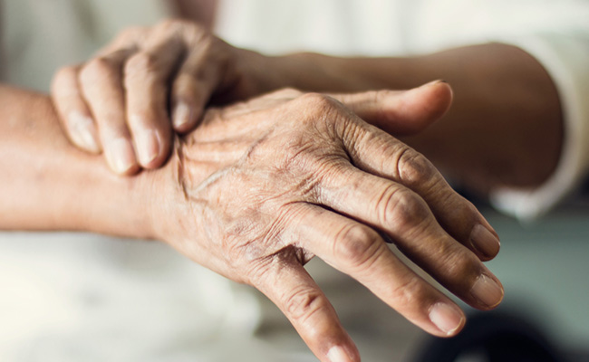 हाथ की स्किन लगी है सिकुड़ने तो, एक महीने लगातार रात में लगाएं इस लेप को, Wrinkles होने लगेंगी कम