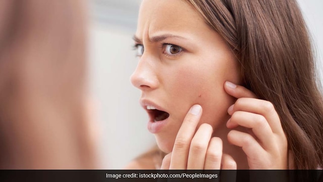 Skincare tips: You should drink enough water to keep your skin healthy