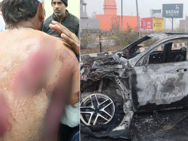 Rishabh Pant Car Accident : क्रिकेटर ऋषभ पंत कार हादसे में हुए घायल