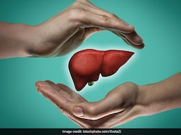Liver Health: These Symptoms On Your Face Could Be Signs Of Fatty Liver Liver Health: These Symptoms On Your Face Could Be Signs Of Fatty Liver