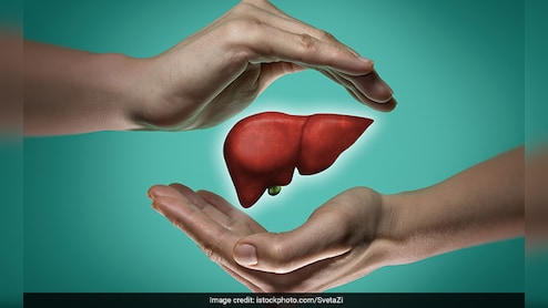 AIIMS के डॉक्टर ने बताया Fatty Liver की वजह बन सकती इस तरह की डाइट, कहीं आप भी तो नहीं कर रहे ये गलती