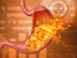 पेट में महसूस हो जलन तो खाकर देख लीजिए ये 5 चीजें, मिलने लगेगी राहत और दिक्कत होगी दूर  