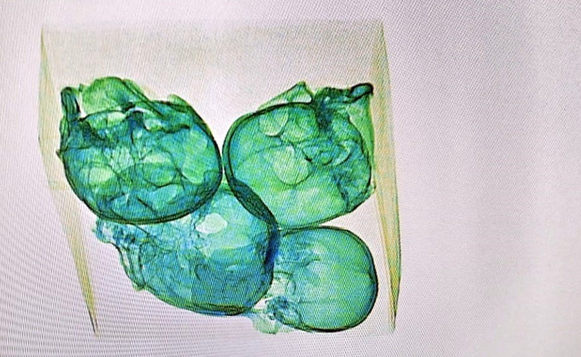 Package For US Intercepted At Mexican Airport. It Had 4 Human Skulls