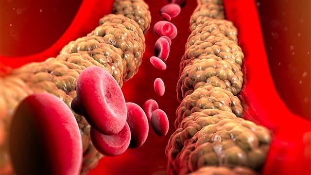 Cholesterol levels may be worsened by consuming popular yet unhealthy winter dishes