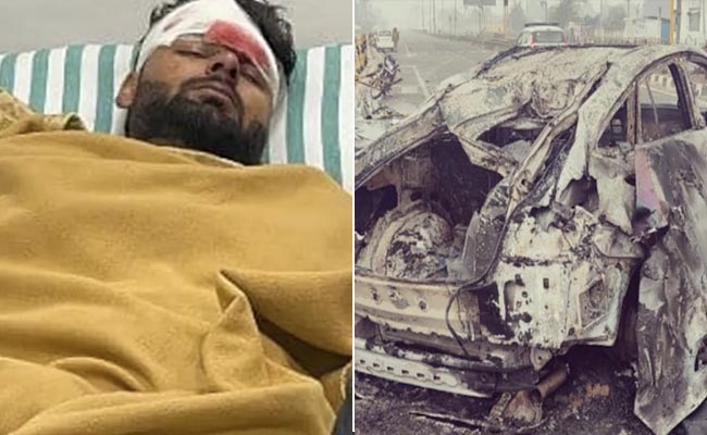 Cricket Body Requests Rishabh Pant Fans To Avoid Visiting Him In Hospital