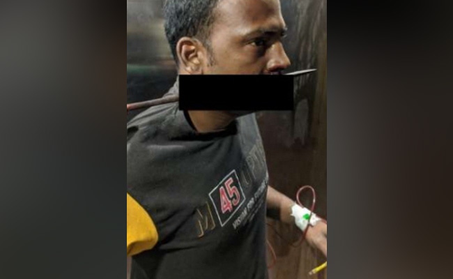 West Bengal Man Travels 65 Km With Trident In His Neck For Operation