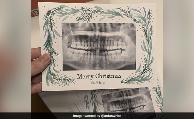 Man Accidentally Prints Neighbour's Dental X-Ray On 90 Christmas Cards, Internet In Splits