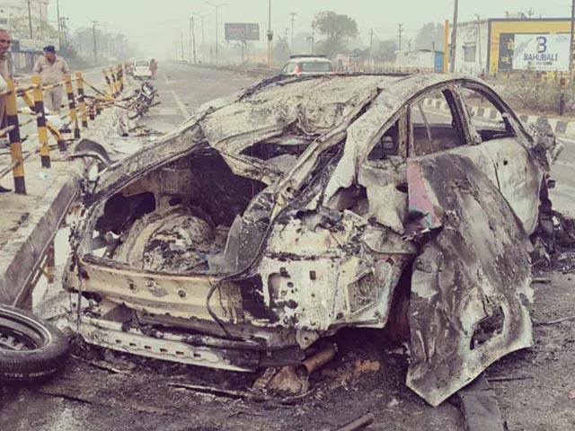 Rishabh Pant Has Cuts On Forehead, Ligament Tear In Knee After Car Crash