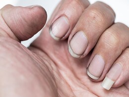 गंदे काले-पीले पड़े नाखूनों को घर पर ही इस तरह करें साफ, पार्लर जाकर मेनिक्योर करवाने की नहीं पड़ेगी जरूरत  गंदे काले-पीले पड़े नाखूनों को घर पर ही इस तरह करें साफ, पार्लर जाकर मेनिक्योर करवाने की नहीं पड़ेगी जरूरत