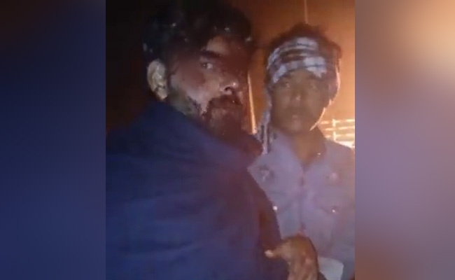 Rishabh Pant Car Accident: कार दुर्घटना के बाद चोटिल ऋषभ पंत का वीडियो आया सामने