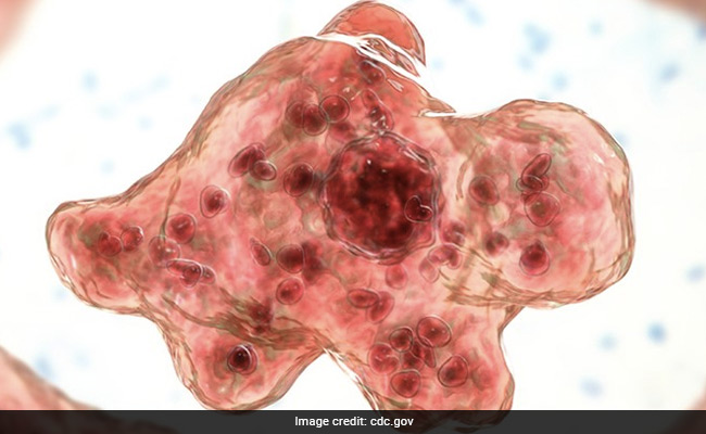 South Korea Registers First Death Linked to 'Brain-Eating Amoeba'