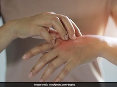 Could Your Skin Indicate Heart Issues? Look Out For These Signs