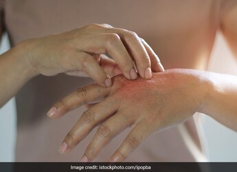 What Is Pollution Rash: Signs And Prevention Tips For Skin Rashes