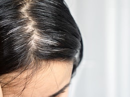 हर बाल मेहंदी लगाकर छुपाते हैं सफेद बाल, तो हफ्ते में 2 बार करें ये काम, White Hair को काला होने में नहीं लगेंगे ज्यादा दिन हर बाल मेहंदी लगाकर छुपाते हैं सफेद बाल, तो हफ्ते में 2 बार करें ये काम, White Hair को काला होने में नहीं लगेंगे ज्यादा दिन