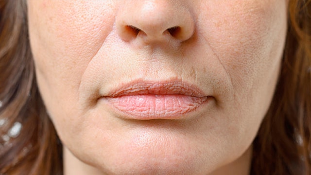 Ozempic Side Effects: From Nausea To Ozempic Face, All The Worrying  Reactions You Could Have