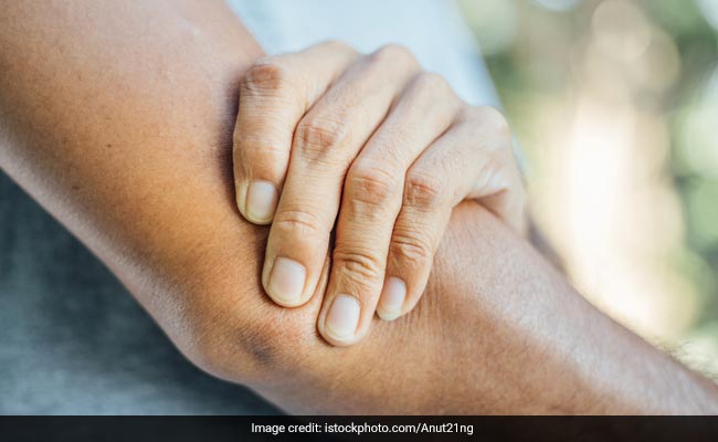 Vitamin D Deficiency: Know Common Signs And Symptoms And Tips To ...