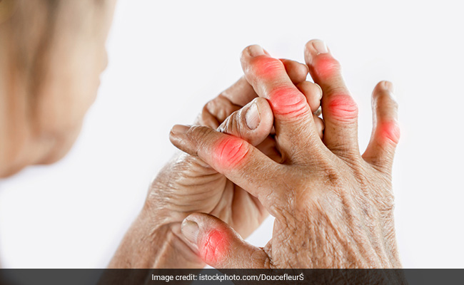 Uric acid level : Blood में कितना होगा यूरिक एसिड का लेवल तो सेहत के लिए है अच्छा ? यहां जानिए