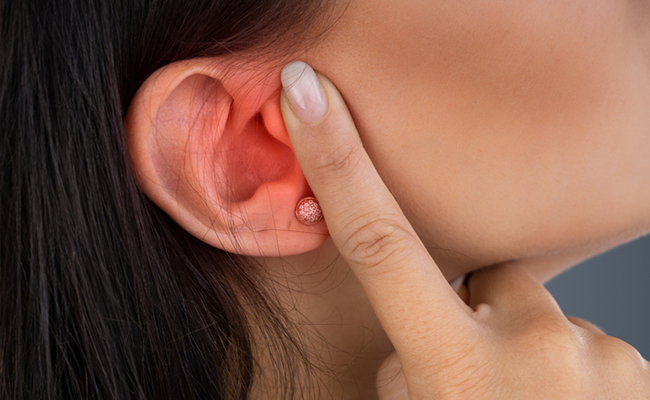 The Valsalva manoeuver is a simple technique to regulate ear pressure