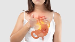 Gastroenterologist Lists Best And Worst Drinks For Heartburn