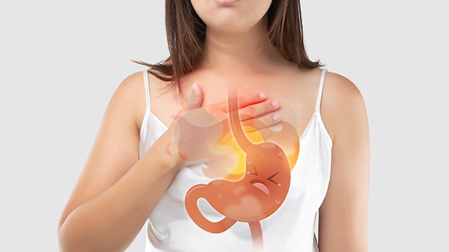 These home remedies provide natural and effective relief from heartburn