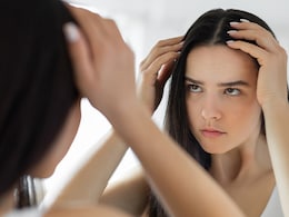 6 Natural Health Hacks To Tackle Winter Scalp Dryness