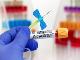 अगर आप  Uric Acid को करना चाहती हैं जड़ से खत्म तो बस डाइट में इन बातों का रखना होगा खास ख्याल अगर आप  Uric Acid को करना चाहती हैं जड़ से खत्म तो बस डाइट में इन बातों का रखना होगा खास ख्याल