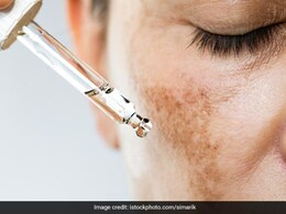 दाग धब्बे और झाइयों को दूर करने के लिए असरदार हैं ये 4 तेल, स्किन पिगमेंटेशन से भी मिलेगा छुटकारा दाग धब्बे और झाइयों को दूर करने के लिए असरदार हैं ये 4 तेल, स्किन पिगमेंटेशन से भी मिलेगा छुटकारा