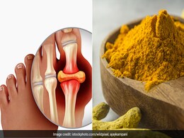 हल्दी से कम करें हाई यूरिक एसिड, जानिए कौन-कौनसे घरेलू नुस्खे Uric Acid Control करने में आते हैं काम  हल्दी से कम करें हाई यूरिक एसिड, जानिए कौन-कौनसे घरेलू नुस्खे Uric Acid Control करने में आते हैं काम