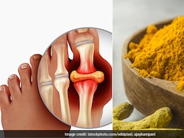 बढ़ गया है गंदा यूरिक एसिड तो इन 4 पीली चीजों को खाना कर दीजिए शुरू, High Uric Acid होने लगेगा कम  बढ़ गया है गंदा यूरिक एसिड तो इन 4 पीली चीजों को खाना कर दीजिए शुरू, High Uric Acid होने लगेगा कम