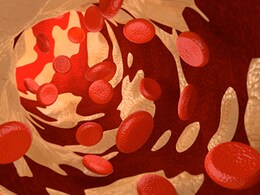 High Cholesterol: हाई कोलेस्ट्रॉल को कंट्रोल करने के लिए अपनाएं ये टिप्स, डायबिटीज भी रहेगा...