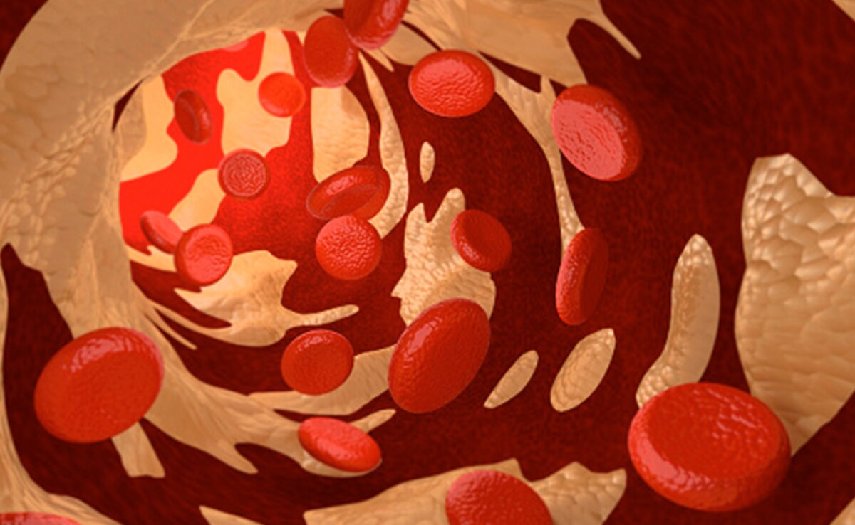 How To Thin Blood Naturally