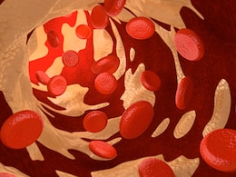 सर्दियों में खून को पतला करने के लिए क्या खाना चाहिए, यहां जानें