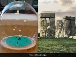 UK-Based Artist Creates Miniature Sculpture Of Stonehenge From Own Kidney Stones UK-Based Artist Creates Miniature Sculpture Of Stonehenge From Own Kidney Stones