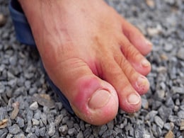 सर्दियों में हाथ-पैरों की उंगलियां सूजने से हो गई हैं लाल तो कुछ घरेलू नुस्खे आ सकते हैं काम, गलने से बचेंगी Fingers  सर्दियों में हाथ-पैरों की उंगलियां सूजने से हो गई हैं लाल तो कुछ घरेलू नुस्खे आ सकते हैं काम, गलने से बचेंगी Fingers