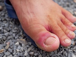 पैरों में दर्द के साथ अक्सर रहती है सूजन, तो शरीर में इस विटामिन की हो सकती है कमी पैरों में दर्द के साथ अक्सर रहती है सूजन, तो शरीर में इस विटामिन की हो सकती है कमी