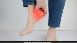 Swollen Ankles? Here Are The Most Common Reasons Behind It