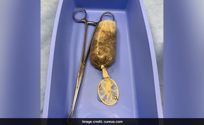 US Man Swallows Condom-Wrapped Banana During "Hormonal Rage" Fit