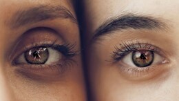 Honey Benefits: शहद में इन चीजों को मिलाकर लगाइए, Dark Circles दूर भगाइए...