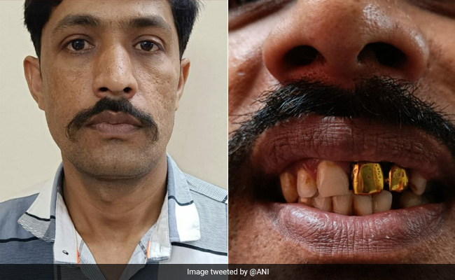 How 2 Gold Teeth Helped Mumbai Cops Catch Man Missing For 15 Years