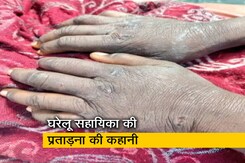 'गर्म चिमटे से पीटा': 5 महीने तक घरेलू सहायिका पर जुल्म करते रहे दंपती 'गर्म चिमटे से पीटा': 5 महीने तक घरेलू सहायिका पर जुल्म करते रहे दंपती