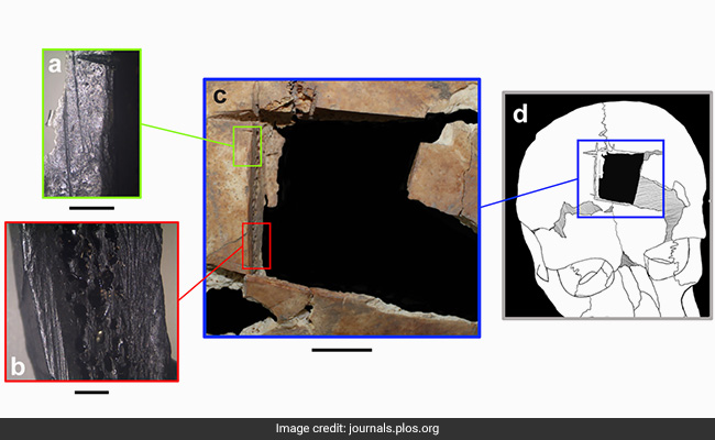 Skull Of Man Buried 3,000 Years Ago Shows Evidence Of Brain Surgery