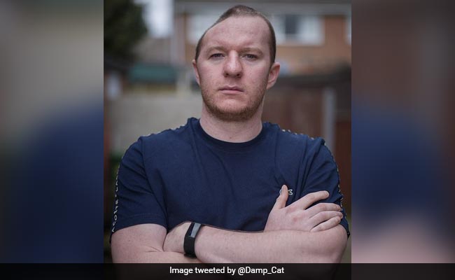 UK Man Missing Half His Skull After One-Punch Assault, Wears Helmet To Go Outside