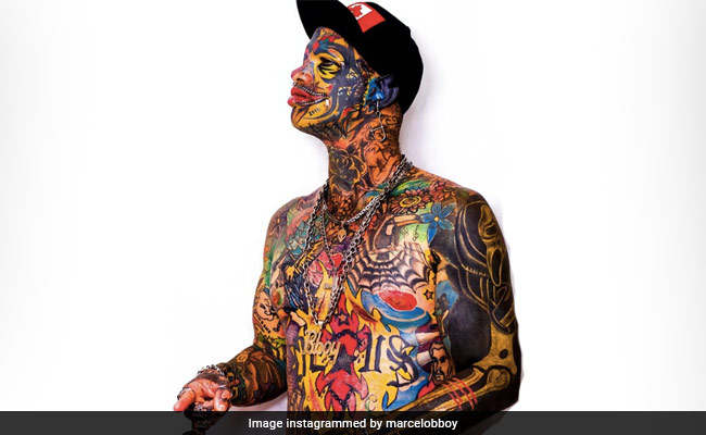 Marcelo "B-boy" Becomes First Person To Have His Hand Surgically Split In Two