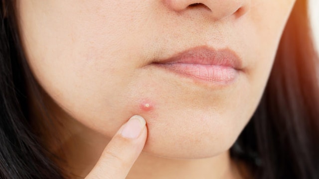 Exfoliate regularly for clearer skin and to reduce pimples
